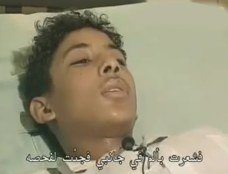 شاب مصري يحمل كيس توأمه في بطنه 16 عاماً!