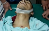استشهاد شاب وإصابة اثنين برصاص الاحتلال بمخيم الدهيشة