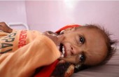 يونيسف: طفل يمني يموت كل 10 دقائق لأسباب يمكن الوقاية منها