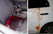 الاحتلال يعلن مقتل مستوطن عملية 