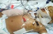 رضيع معجزة.. ينجو من الموت بعد أن سقط من الطابق الـ11 