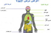 الصحة العالمية تبحث فرض قيود على السفر لاحتواء 