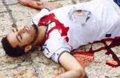 مصدر عبري: منفذ عملية الطعن بالقدس لازال حيا