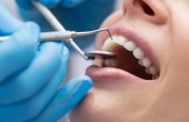 dental-procedures-min-925x425.jpg