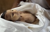 AA-20250822-38891427-38891424-5MONTHOLD_GHADIR_BREIKA_DIES_UNDER_ISRAELI_BLOCKADE_ON_GAZA.jpg-eb2b8950-7e13-4196-a26a-c531d130e9b9.jpg