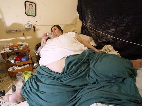 وفاة أسمن شخص في العالم يزن 597 كيلو‏