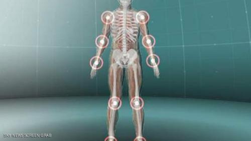 جهاز جديد يسهم بعلاج التهاب المفاصل