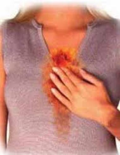 كيف تتجنب الحرقة؟