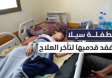 #تقرير | تحتاج للعلاج في الخارج.. مراسل فلسطين اليوم إبراهيم إبراهيم يوثق معاناة الطفلة سيلا ماضي 8 أعوام واتي فقدت ساقيها بعد أن قصف الاحتلال خيمة عائلتها في #خانيونس جنوب قطاع #غزة