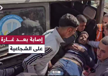 كاميرا فلسطين اليوم توثق لحظة وصول إصابة جراء غارة شرق الشجاعية  في مدينة #غزة