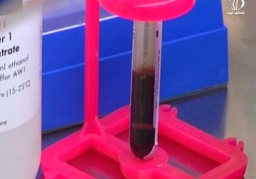 بعوضة النمر الاسيوي تنقل ما يزيد عن 22 مرضا فيروسيا، وأخطرها فيروس حمى الضنك - رغدة عتمة - 7 - 8 - 2016