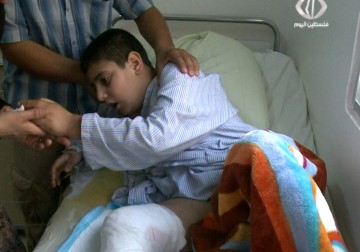 مناشدة إنسانية لتأمين تكلفة عملية زرع جلد لطفل فلسطيني في مخيم برج الشمالي – 05 – 09 – 2015 – مريم الحج موسى