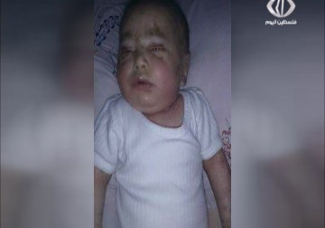 استشهاد الطفلة فاطمة الحسين جراء النقص الحاد في الأدوية داخل مخيم اليرموك – 7 – 8 – 2015 – نور الزمان شوقي