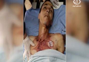 محمد أبو عمشة  الأطرش .. شهيد جديد تعدمه قوات الاحتلال بدم بارد عند حاجز زعترة  - 17 – 8 – 2015 – فاطمة ابراهيم