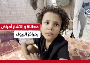 تفشي الأمراض ينهك النازحين في خيام الإيواء بغزة وسط غياب المياه ومواد التنظيف