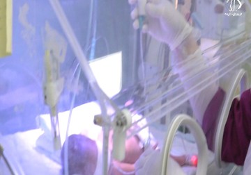 سيدة من غزة ترزق بثلاثة توائم في مشفى متخصص بنابلس  - 17 - 6 - 2016