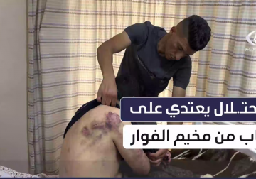 جنود الاحتلال يعتدون على الشاب عز الدين الدرابيع قرب حاجز في #أريحا، ما أسفر عن إصابته ونقله إلى مستشفى #الخليل