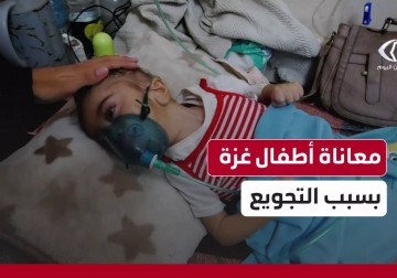 جوع يفتك بأطفال غزة في مجمع ناصر وسط حصار خانق ونقص حاد بالغذاء والدواء