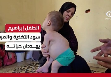  مأساة الطفل إبراهيم الذي يواجه خطر الموت بسبب ضمور شديد في جسده جراء سوء التغذية
