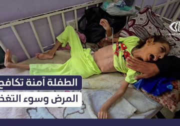 مأساة الطفلة آمنة معروف التي أرهقها سوء التغذية والأمراض في ظل حصار إسرائيلي