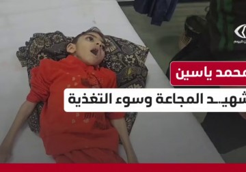 استـ.ـشهاد الطفل محمد مصطفى ياسين من حي الزيتون في مدينة غزة بسبب الجوع وسوء التغذية