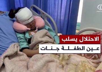 إصابة الطفلة جنات المطور في عينيها ووجهها جراء إطلاق الاحتلال النار على منزلهم في سعير شمال الخليل