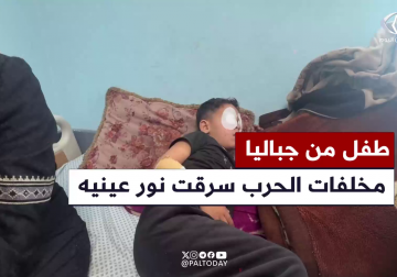 #تقرير | من داخل مستشفى الإندونيسي .. مراسل فلسطين اليوم خميس أبو حصيرة يروي مأساة الطفل محمد حجازي من مخيم جباليا، بعد أن فقد بصره نتيجة مخلفات الاحتلال