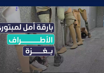 #تقرير | من قلب المعاناة تولد بارقة أمل..  مستشفى حمد في غزة يحتضن جراح العشرات، ويمنحهم فرصة جديدة للحياة بتركيب الأطراف الصناعية..  مراسلنا عماد دلول زار المستشفى وأعد التقرير التالي..