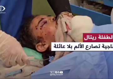 #تقرير | جراحها أعمق من الجسد.. مراسل فلسطين اليوم أنس بركة ينقل قصة الناجية الوحيدة الطفلة ريتال الدحدوح التي ترقد في مستشفى شهداء الأقصى بعد إصابات خطيرة