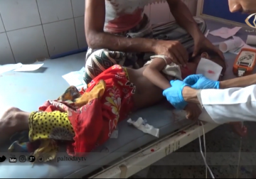 تقرير | إستشهاد مواطن وجرح أطفال جراء قصف استهدف مديرية التحيتا بمحافظة الحديدة