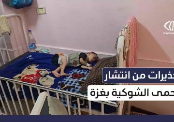  تفشّي الحمى الشوكية في غزة.. إصابات متزايدة ونظام صحي منهار