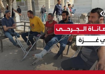 مأساة من بُترت أطرافهم خلال العدوان الإسرائيلي