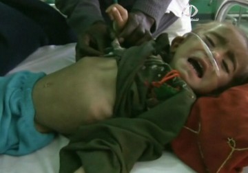 ازدياد عدد الأطفال المصابين بسوء التغذية في أفغانستان - 27 - 2 - 2014 - فاطمة ابراهيم
