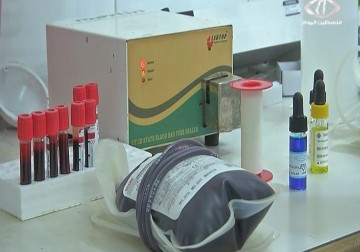 بنك الدم المركزي يعمل دون المحاليل الأساسية لفحص سلامة الدم  - 7 - 2  - 2015 -  أكرم دلول