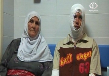 إصابة فتى بمخلفات لجيش الاحتلال في بلدة طمون بالأغوار - 26 - 5 - 2015 - امتثال هنداوي