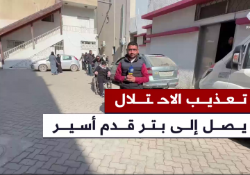 أقدم الاحتلال على بتر قدمه عقب اعتقاله من مجمع الشفاء الطبي