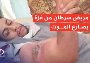 معاناة شاب نازح مصاب بمرض السرطان خلال العدوان الإسرائيلي ويناشد العالم لإنقاذه قبل فوات الأوان