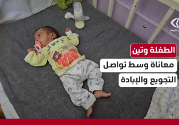 معاناة الرضيعة وتين أبو بكر التي تكافح للبقاء في ظل سوء التغذية وانعدام الرعاية الطبية