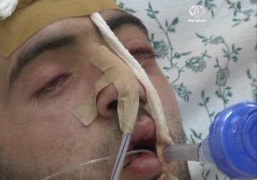 كاميرا فلسطين اليوم رافقت الشهيد جعفر عوض في غرفة العناية المركزة - 10  – 4 – 2015 – فداء نصر