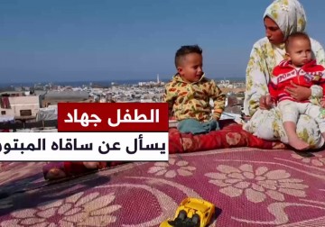 طفل فلسطيني فقد قدميه في قصف إسرائيلي على مواصي خان يونس جنوب قطاع غزة.