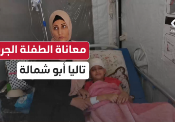تقرير | معاناة الطفلة الجريحة تاليا أبو شمالة