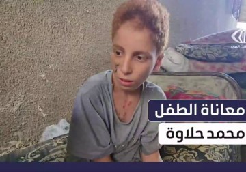 الطفل محمد حلاوة فقد قدمه إثر استهدافه بطائرة مسيرة غرب جباليا أثناء جمعه الحطب لإعالة أسرته