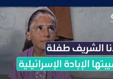 #تقرير | سرقت الحرب ضفائرها الجميلة.. مراسل فلسطين اليوم إبراهيم إبراهيم يلتقي بالطفلة لانا الشريف التي شاب شعرها وأصيبت بمرض البهاق بسبب شدة الخوف من القصف الإسرائيلي المستمر على قطاع #غزة وتخبرنا عن تفاصيل ما جرى