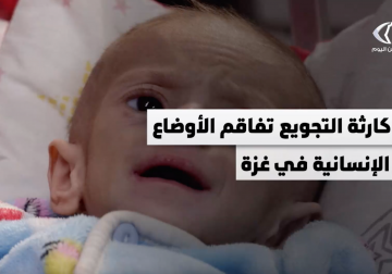 كارثة التجويع تفاقم الأوضاع الإنسانية في غزة