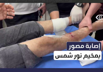 إصابة مصوّر الجزيرة فادي ياسين خلال تغطيته وقفة نازحي مخيم نور شمس 