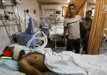 تقرير| عبوة غاز مسيل للدموع تستقر بوجه الشاب هيثم أبو سبلة