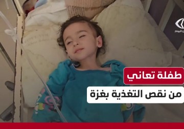 الطفلة لين الركيعي (عامان ونصف) تفقد أكثر من نصف وزنها بسبب سوء التغذية في #غزة