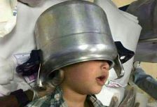 إنقاذ طفل سعودي حشر رأسه في  حلة طعام 