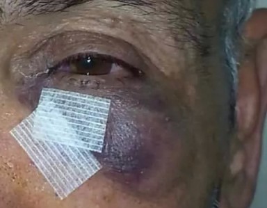 مستوطنون يعتدون على المسن أحمد محمود القاق