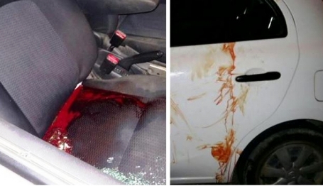 الاحتلال يعلن مقتل مستوطن عملية 